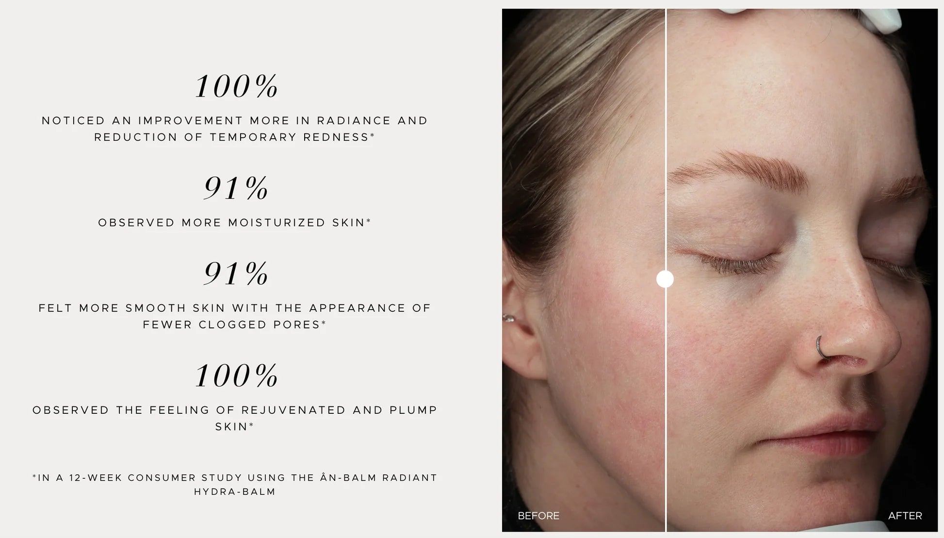 ÂN-BALM Radiant Hydra-Balm